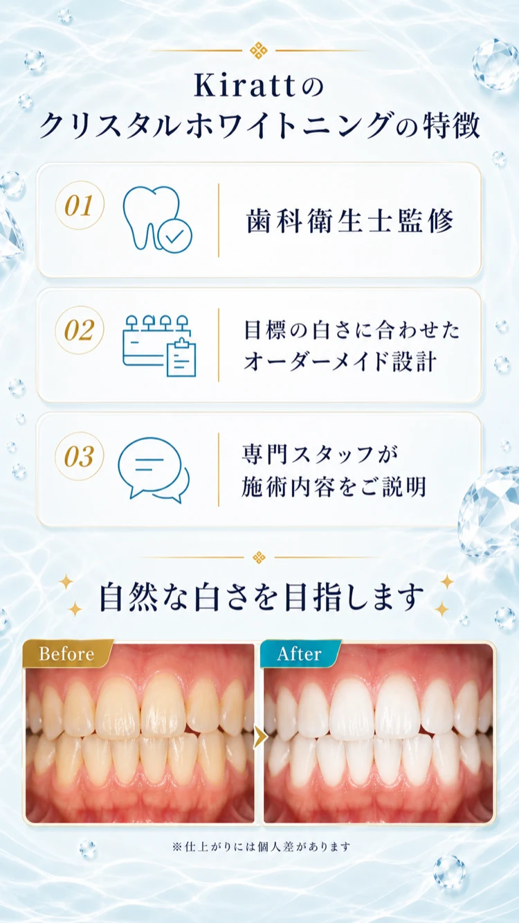Kirattのクリスタルホワイトニングの特徴とビフォーアフター