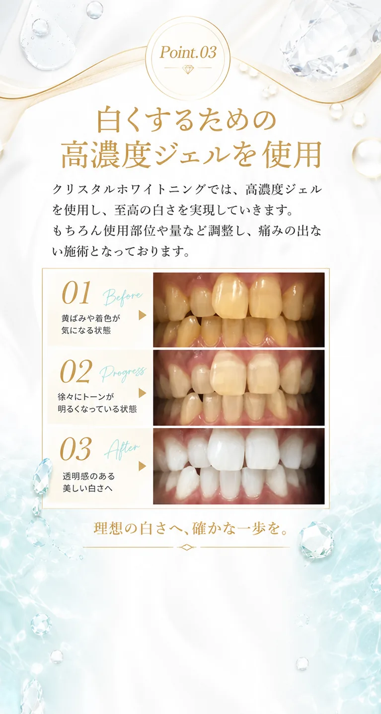 Point.03 白くするための高濃度ジェルを使用