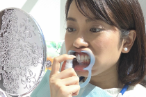 ホワイトニング溶液塗布