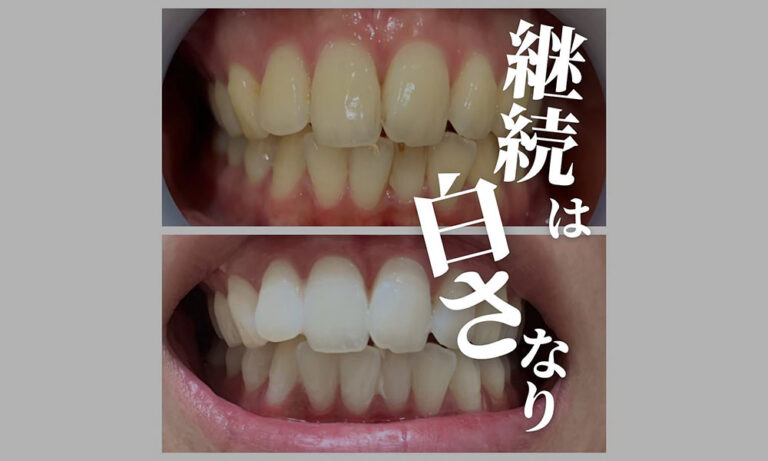 継続は白さなり