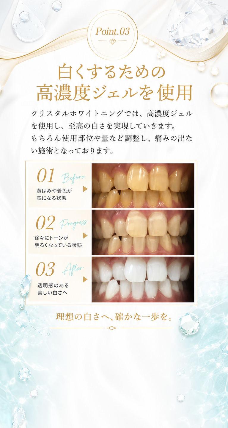 Point.03 白くするための高濃度ジェルを使用