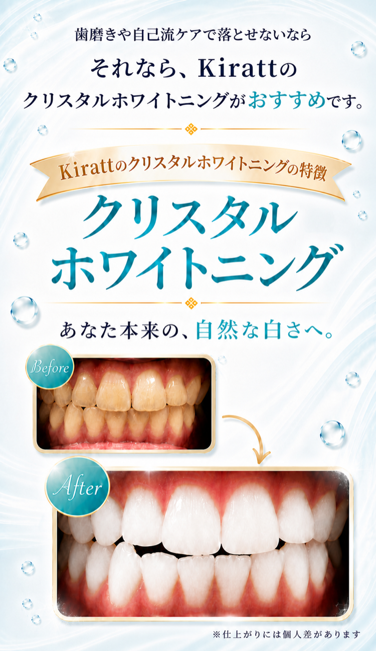 それならKirattのクリスタルホワイトニングがおすすめです