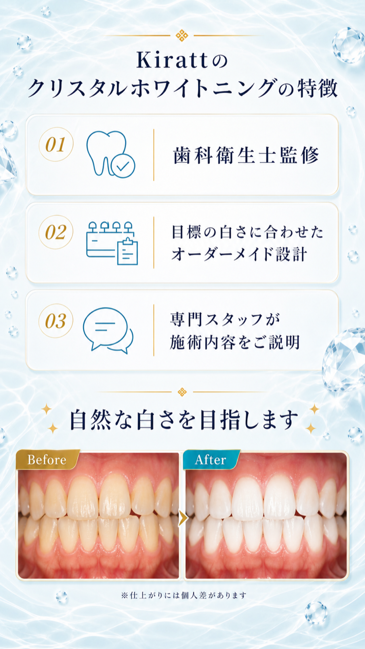 Kirattのクリスタルホワイトニングの特徴とビフォーアフター
