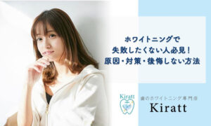 【体験談あり】ホワイトニングで失敗したくない人必見！原因・対策・後悔しない方法