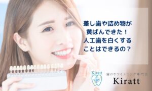 Kirattブログタイトル【差し歯や詰め物が黄ばんできた！人工歯を白くすることはできるの？】