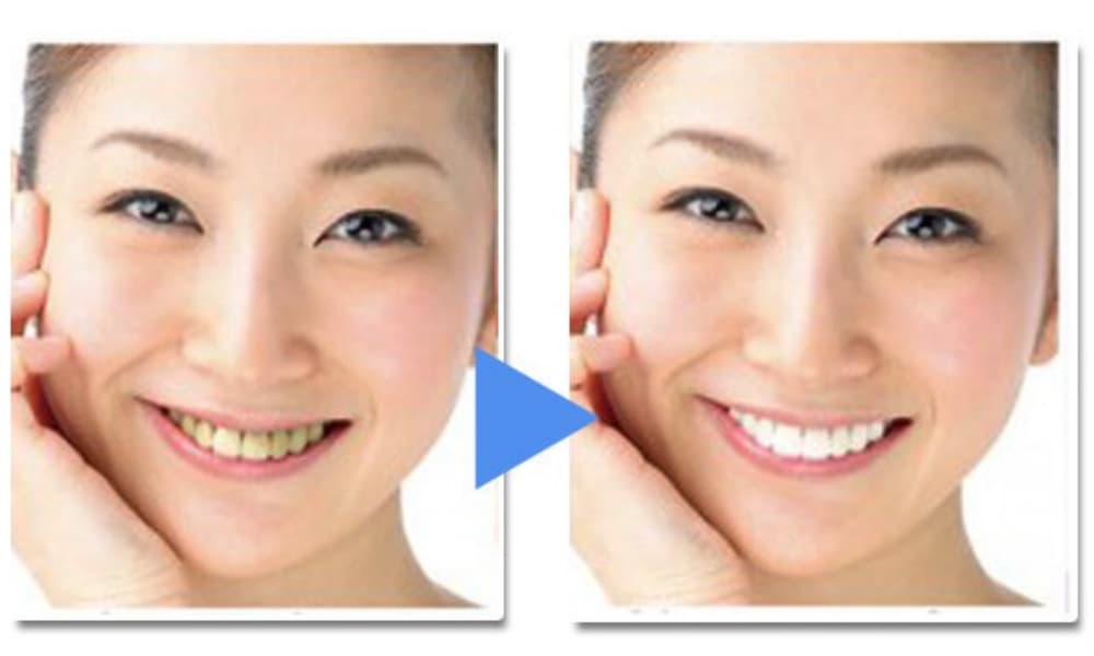 歯の色が違う同じ顔の女性が並んだ画像