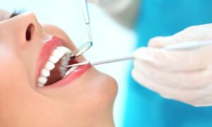 歯科検診を受けている女性の口元の画像