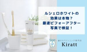 ルシェロホワイトの効果は本物？最速ビフォーアフター写真で検証！