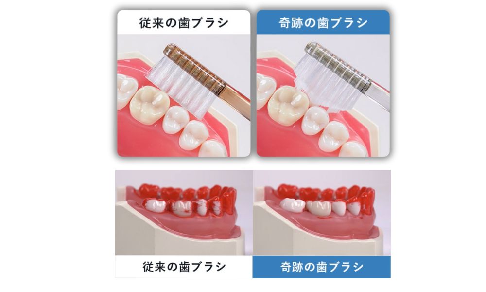 奇跡の歯ブラシと従来の歯ブラシの比較画像