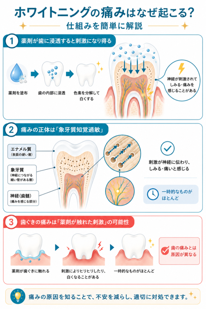 ホワイトニングによる痛みの原因