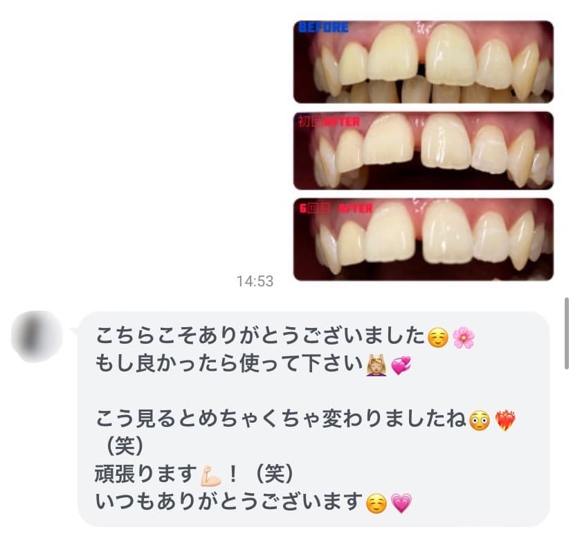 Kiratt茨城牛久店 ホワイトニングを受けられての感想③